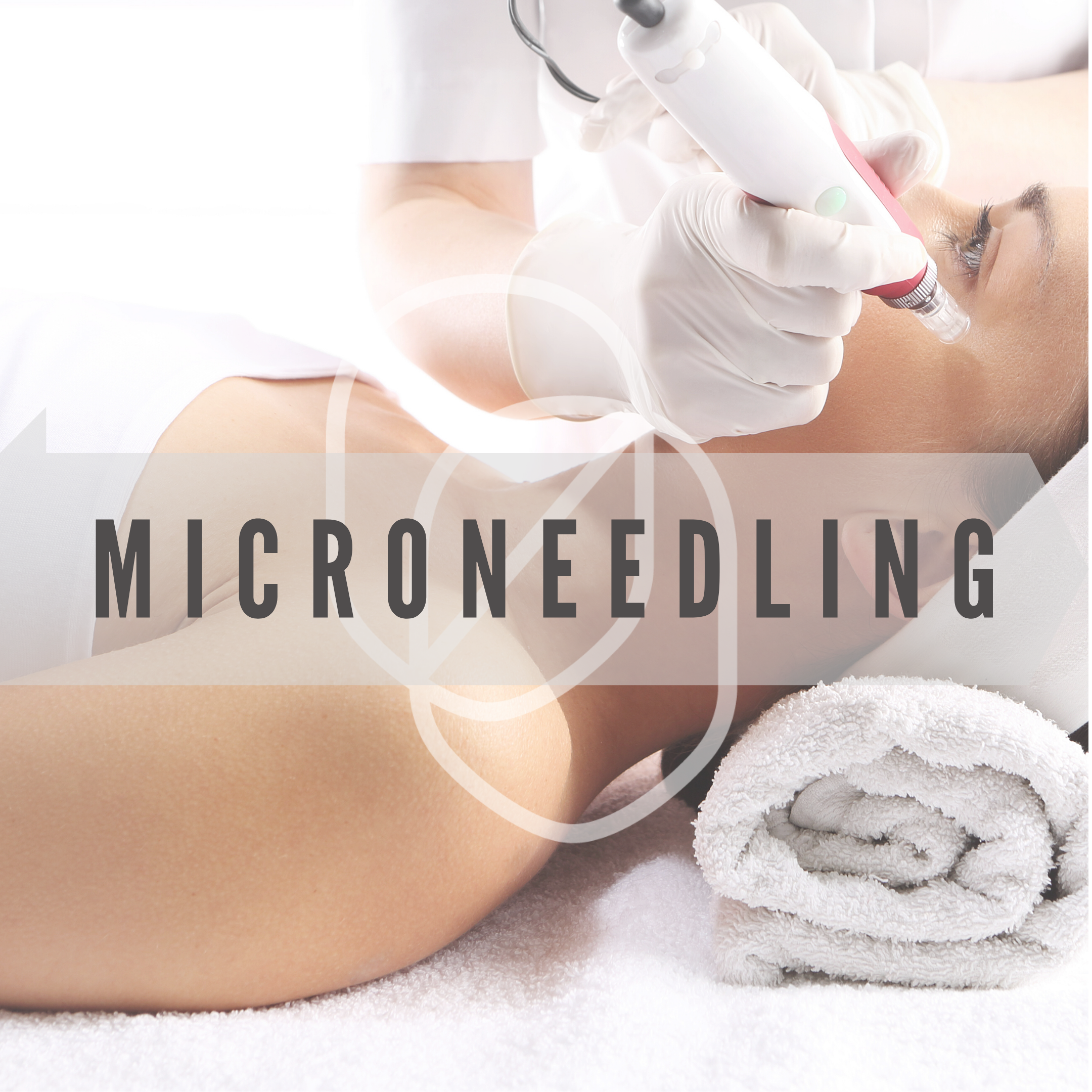 Microneedling Clinica Miro1